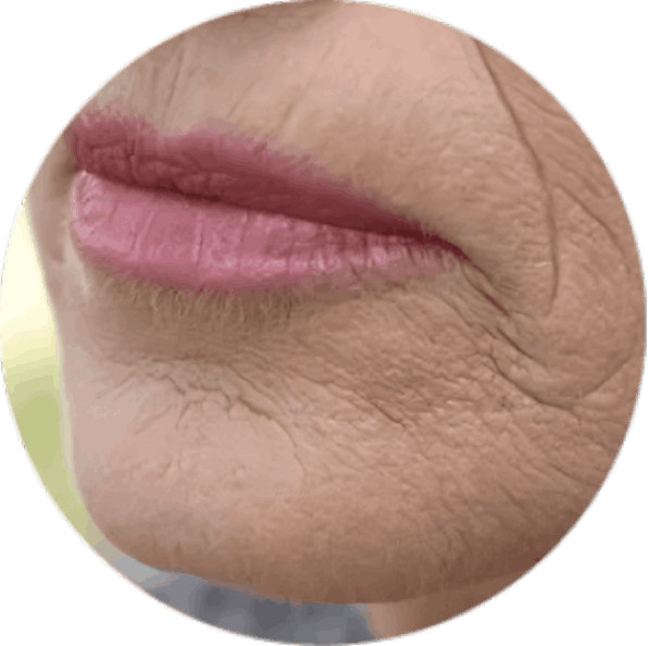 GloraMD 
