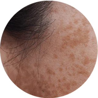 GloraMD 