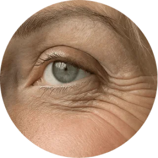GloraMD 