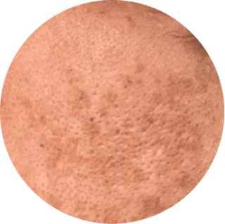GloraMD 